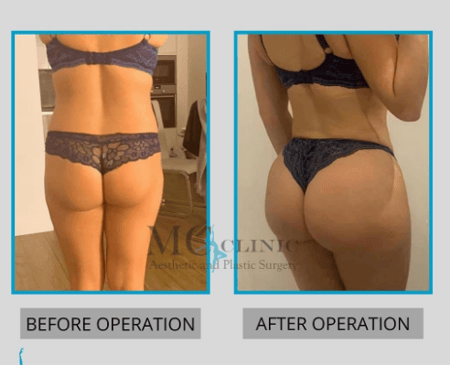 Slider image (2) MEHMET CEBER CLINIC